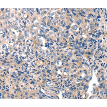 Immunohistochemistry - GRIN2D Antibody from Signalway Antibody (37004) - Antibodies.com