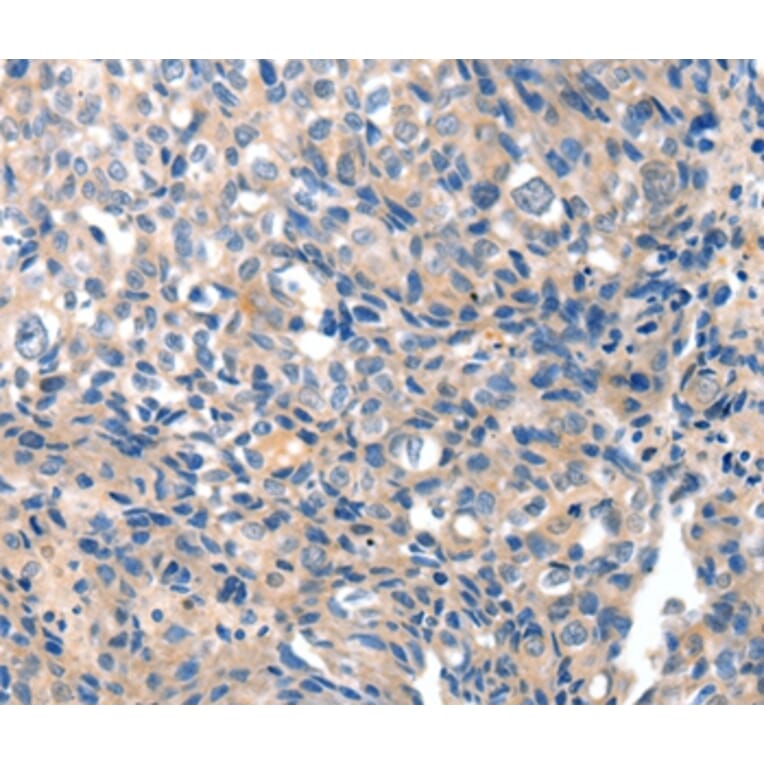 Immunohistochemistry - GRIN2D Antibody from Signalway Antibody (37004) - Antibodies.com