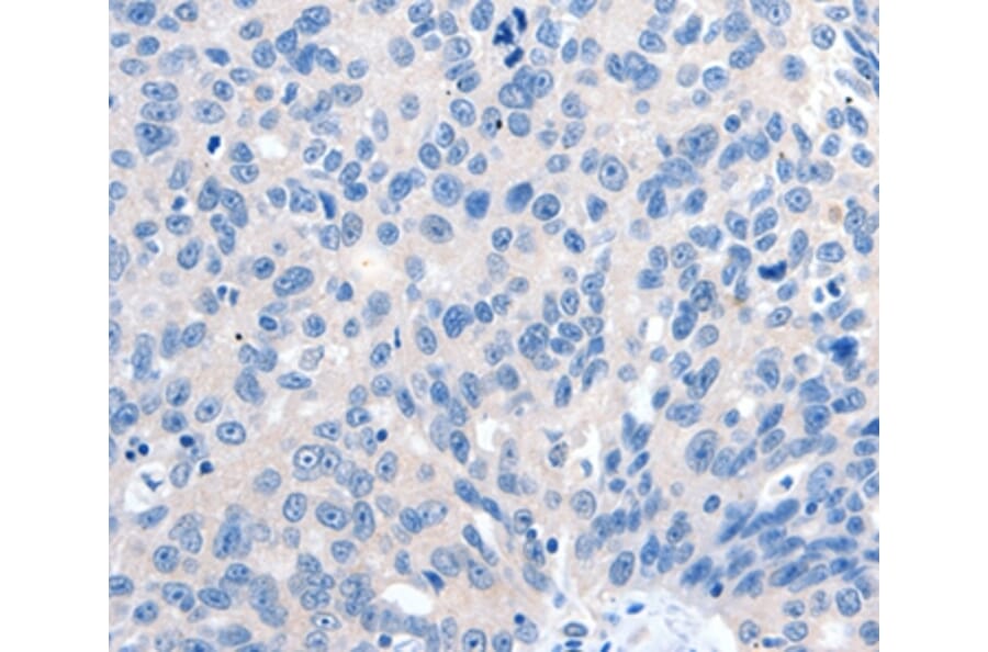 Immunohistochemistry - GRIN2D Antibody from Signalway Antibody (37004) - Antibodies.com
