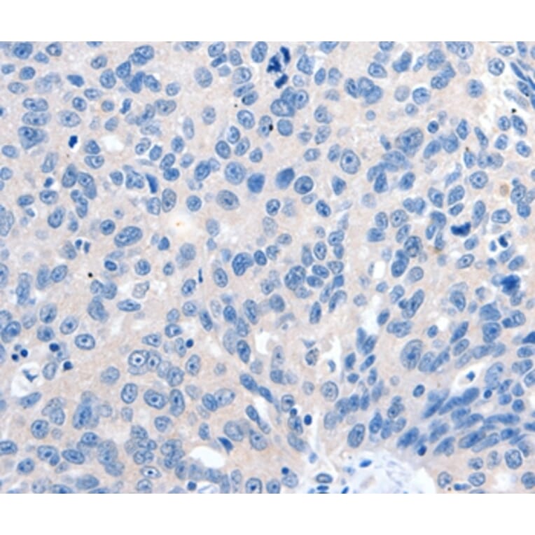Immunohistochemistry - GRIN2D Antibody from Signalway Antibody (37004) - Antibodies.com