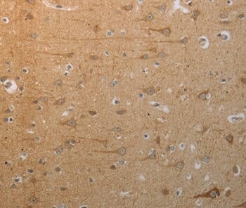 Immunohistochemical analysis of paraffin-embedded Human brain tissue using #37029 at dilution 1/50.