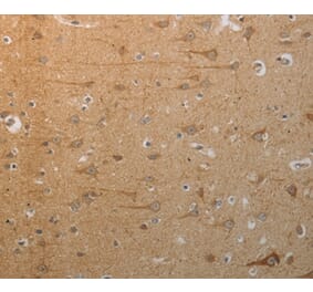 Immunohistochemistry - SLC4A7 Antibody from Signalway Antibody (37029) - Antibodies.com