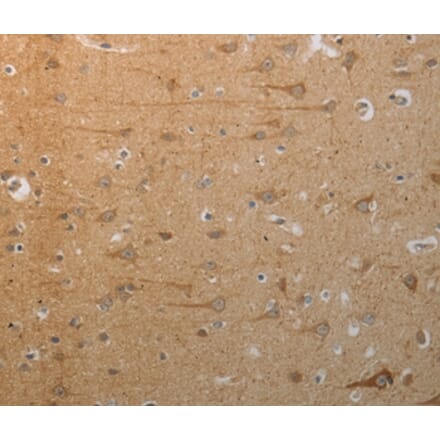 Immunohistochemistry - SLC4A7 Antibody from Signalway Antibody (37029) - Antibodies.com