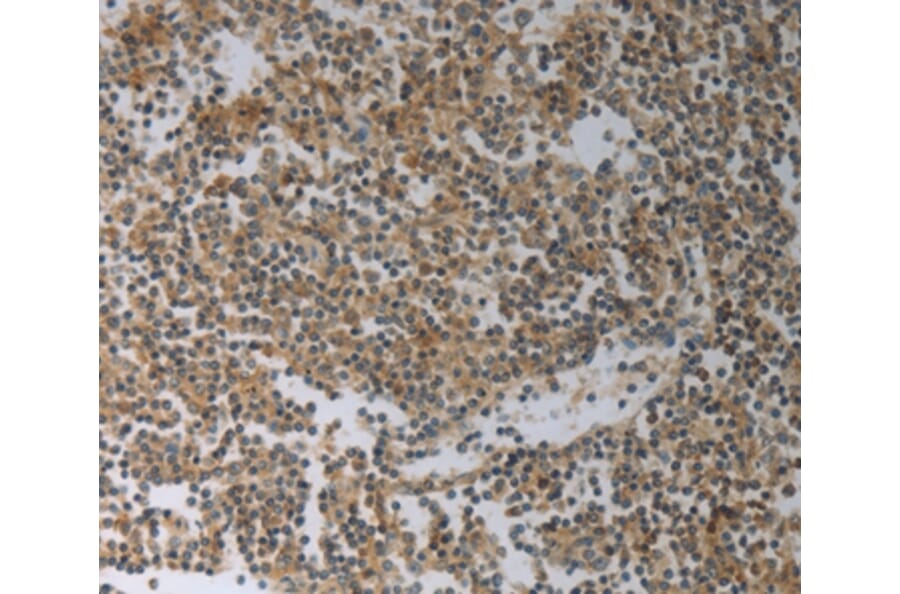 Immunohistochemistry - SLC4A7 Antibody from Signalway Antibody (37029) - Antibodies.com