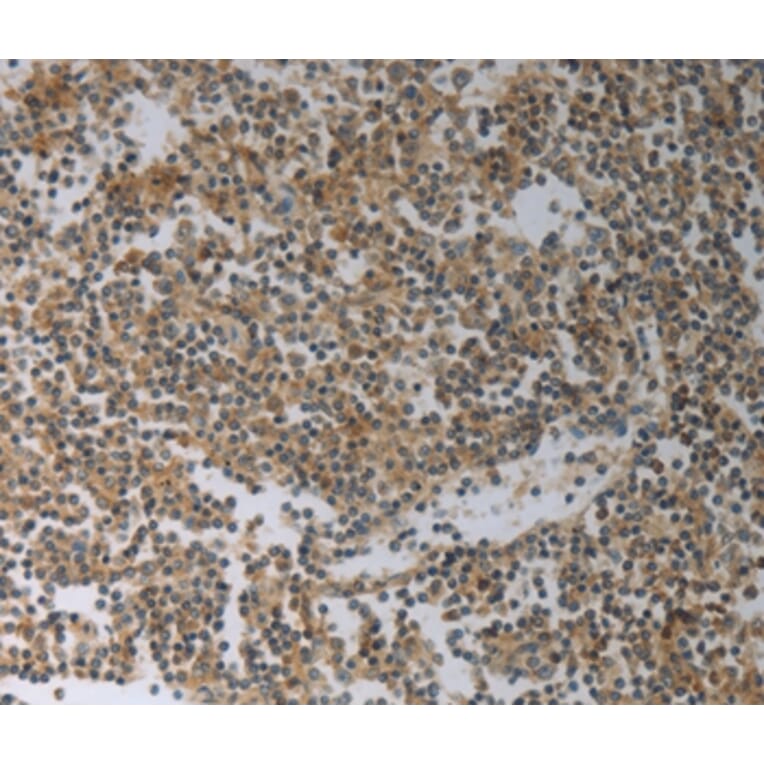 Immunohistochemistry - SLC4A7 Antibody from Signalway Antibody (37029) - Antibodies.com