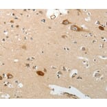 Immunohistochemistry - SREBF2 Antibody from Signalway Antibody (37043) - Antibodies.com