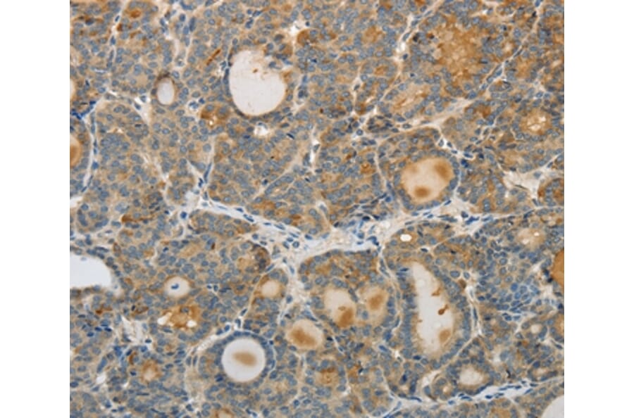 Immunohistochemistry - SREBF2 Antibody from Signalway Antibody (37043) - Antibodies.com