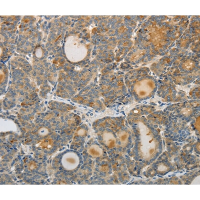Immunohistochemistry - SREBF2 Antibody from Signalway Antibody (37043) - Antibodies.com