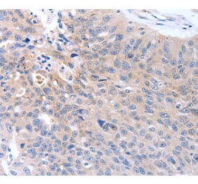 Immunohistochemistry - MAP3K4 Antibody from Signalway Antibody (37046) - Antibodies.com