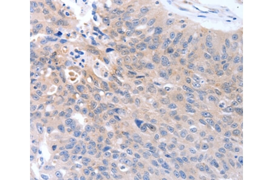 Immunohistochemistry - MAP3K4 Antibody from Signalway Antibody (37046) - Antibodies.com