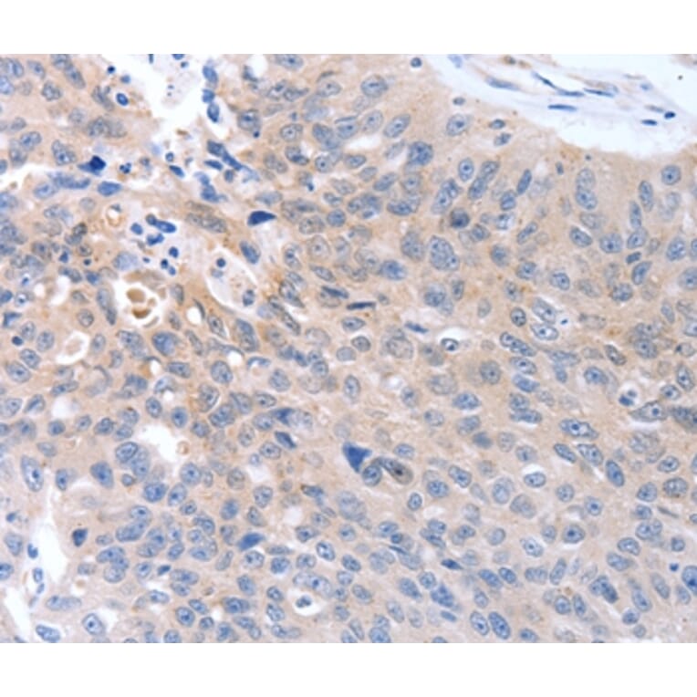 Immunohistochemistry - MAP3K4 Antibody from Signalway Antibody (37046) - Antibodies.com