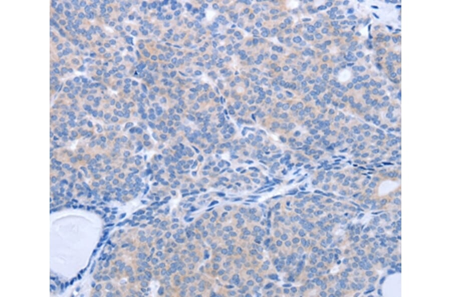 Immunohistochemistry - MAP3K4 Antibody from Signalway Antibody (37046) - Antibodies.com