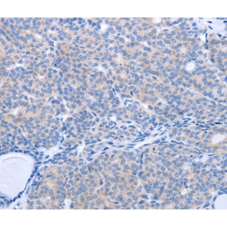 Immunohistochemistry - MAP3K4 Antibody from Signalway Antibody (37046) - Antibodies.com