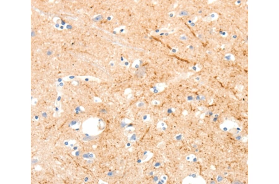 Immunohistochemistry - MAP4K1 Antibody from Signalway Antibody (37047) - Antibodies.com