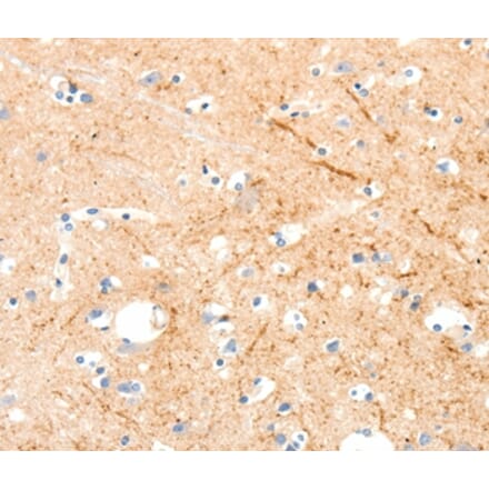 Immunohistochemistry - MAP4K1 Antibody from Signalway Antibody (37047) - Antibodies.com