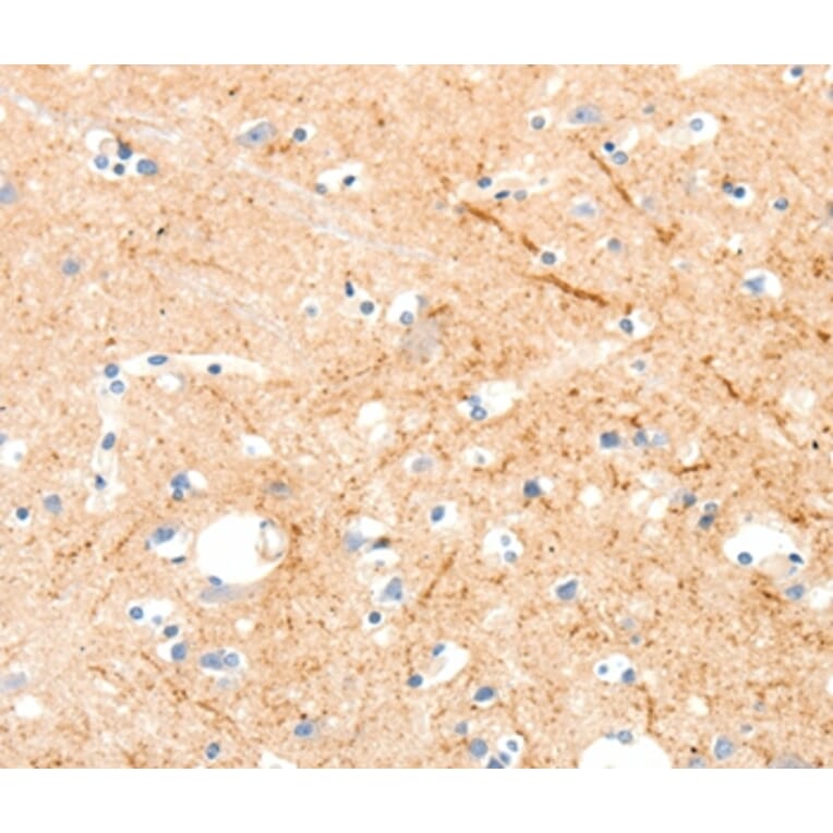 Immunohistochemistry - MAP4K1 Antibody from Signalway Antibody (37047) - Antibodies.com