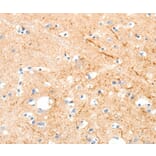 Immunohistochemistry - MAP4K1 Antibody from Signalway Antibody (37047) - Antibodies.com