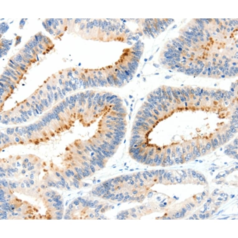 Immunohistochemistry - MAP4K1 Antibody from Signalway Antibody (37047) - Antibodies.com