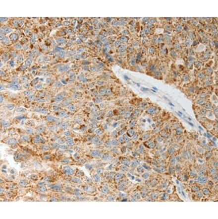 Immunohistochemistry - COL4A3 Antibody from Signalway Antibody (37058) - Antibodies.com
