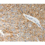 Immunohistochemistry - COL4A3 Antibody from Signalway Antibody (37058) - Antibodies.com