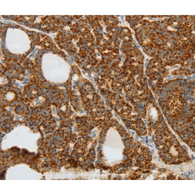 Immunohistochemistry - COL4A3 Antibody from Signalway Antibody (37058) - Antibodies.com