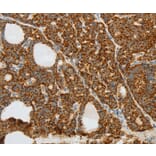 Immunohistochemistry - COL4A3 Antibody from Signalway Antibody (37058) - Antibodies.com