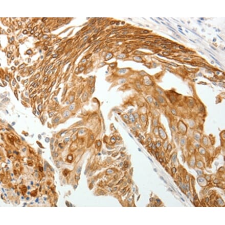 Immunohistochemistry - TMSB10 Antibody from Signalway Antibody (37060) - Antibodies.com