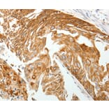 Immunohistochemistry - TMSB10 Antibody from Signalway Antibody (37060) - Antibodies.com