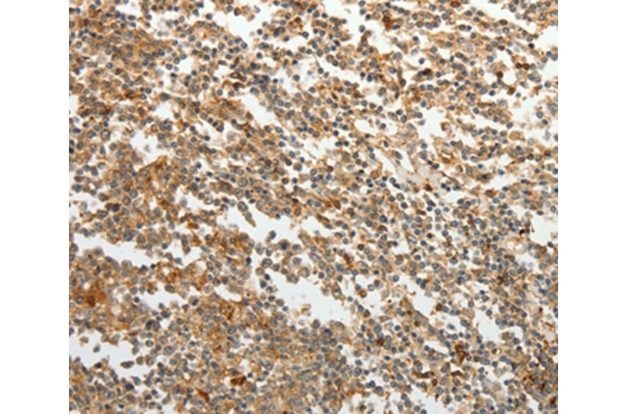 Immunohistochemistry - TMSB10 Antibody from Signalway Antibody (37060) - Antibodies.com