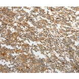 Immunohistochemistry - TMSB10 Antibody from Signalway Antibody (37060) - Antibodies.com