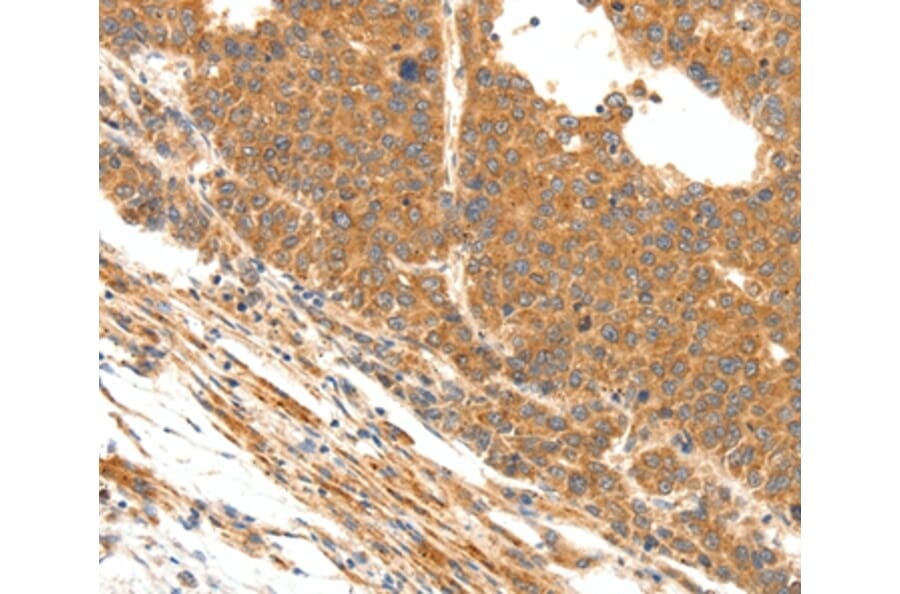 Immunohistochemistry - DOPEY1 Antibody from Signalway Antibody (37064) - Antibodies.com