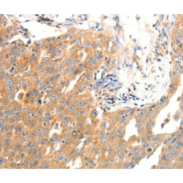 Immunohistochemistry - DOPEY1 Antibody from Signalway Antibody (37064) - Antibodies.com