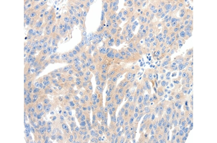 Immunohistochemistry - NFATC2 Antibody from Signalway Antibody (37065) - Antibodies.com