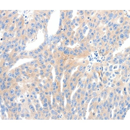 Immunohistochemistry - NFATC2 Antibody from Signalway Antibody (37065) - Antibodies.com