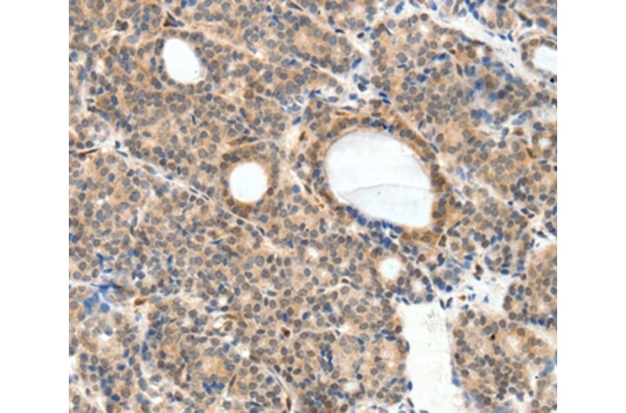Immunohistochemistry - NFATC2 Antibody from Signalway Antibody (37065) - Antibodies.com