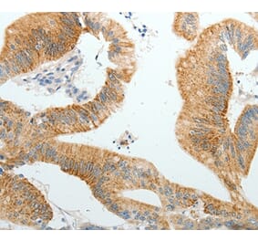Immunohistochemistry - PGBD5 Antibody from Signalway Antibody (37066) - Antibodies.com
