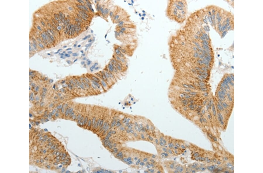 Immunohistochemistry - PGBD5 Antibody from Signalway Antibody (37066) - Antibodies.com