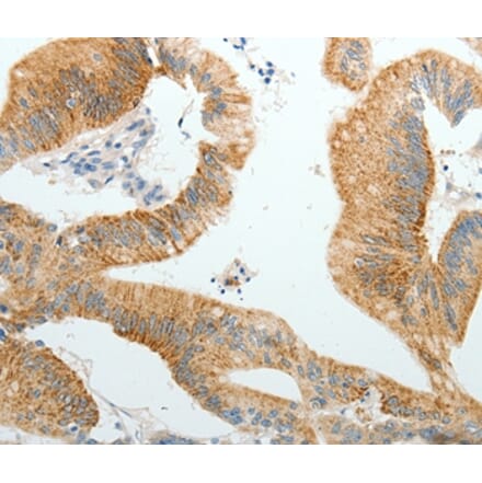 Immunohistochemistry - PGBD5 Antibody from Signalway Antibody (37066) - Antibodies.com