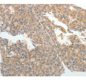 Immunohistochemistry - ABCB11 Antibody from Signalway Antibody (37070) - Antibodies.com