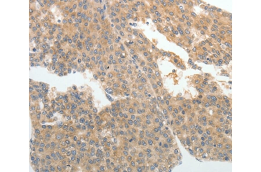 Immunohistochemistry - ABCB11 Antibody from Signalway Antibody (37070) - Antibodies.com