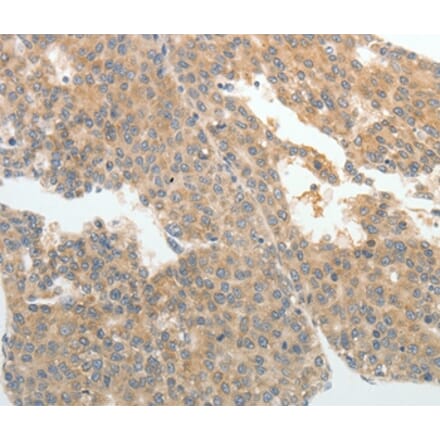 Immunohistochemistry - ABCB11 Antibody from Signalway Antibody (37070) - Antibodies.com