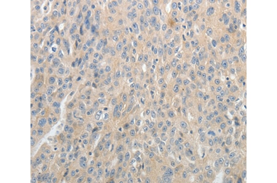 Immunohistochemistry - ABCB11 Antibody from Signalway Antibody (37070) - Antibodies.com