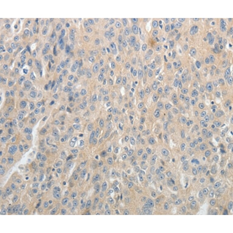Immunohistochemistry - ABCB11 Antibody from Signalway Antibody (37070) - Antibodies.com