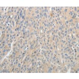 Immunohistochemistry - ABCB11 Antibody from Signalway Antibody (37070) - Antibodies.com