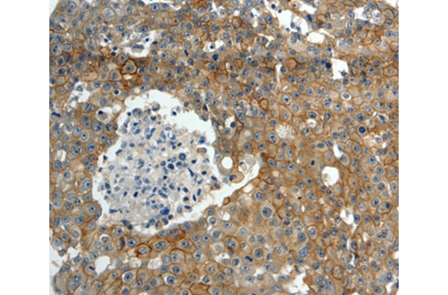 Immunohistochemistry - ABCC10 Antibody from Signalway Antibody (37071) - Antibodies.com