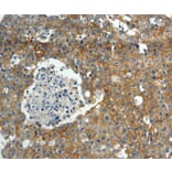 Immunohistochemistry - ABCC10 Antibody from Signalway Antibody (37071) - Antibodies.com