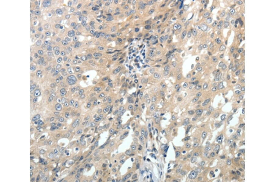 Immunohistochemistry - ABCC10 Antibody from Signalway Antibody (37071) - Antibodies.com