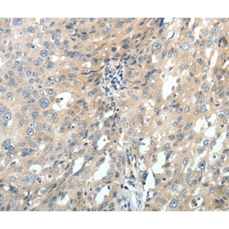 Immunohistochemistry - ABCC10 Antibody from Signalway Antibody (37071) - Antibodies.com