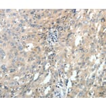 Immunohistochemistry - ABCC10 Antibody from Signalway Antibody (37071) - Antibodies.com
