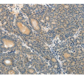 Immunohistochemistry - ABCC12 Antibody from Signalway Antibody (37072) - Antibodies.com